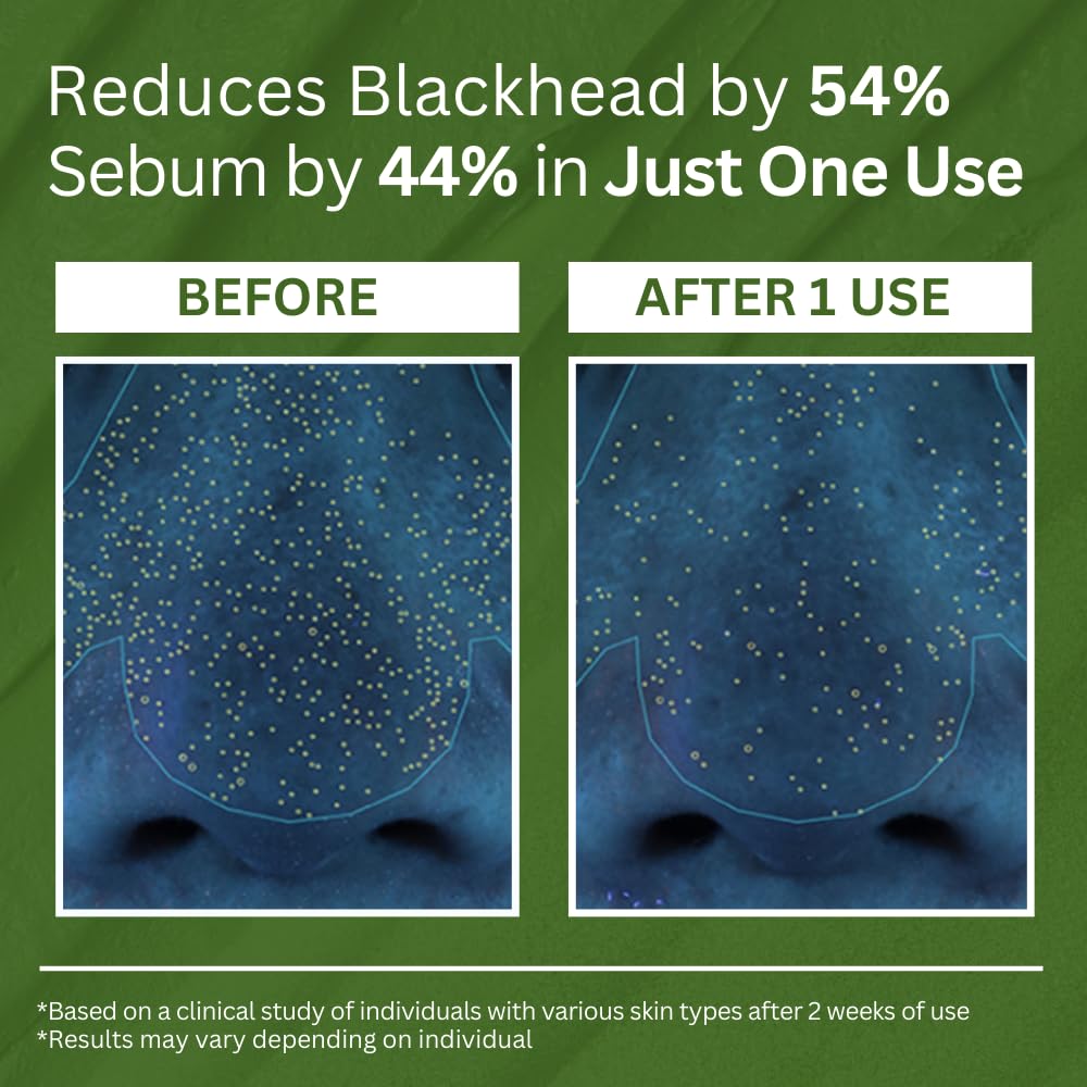 P.CALM Holy Basil Bubble Deep Mask (original)| قناع الفقاعات العميق بالريحان المقدس من بي.كالم – لتنظيف المسام والرؤوس السوداء، بطين كوري وغسيل فقاعي (90 جم / 3.17 أونصة)