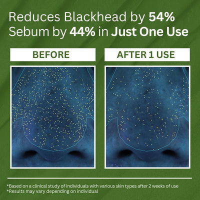 P.CALM Holy Basil Bubble Deep Mask (original)| قناع الفقاعات العميق بالريحان المقدس من بي.كالم – لتنظيف المسام والرؤوس السوداء، بطين كوري وغسيل فقاعي (90 جم / 3.17 أونصة)