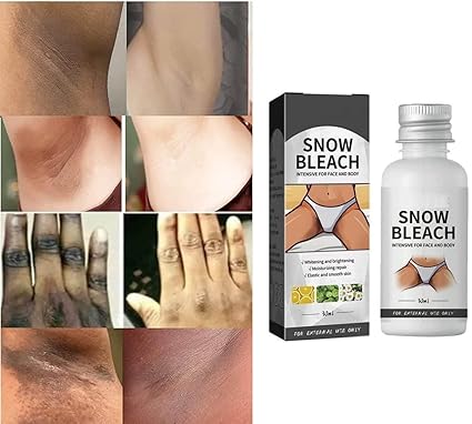 ✨ كريم إزالة البقع الداكنة ✨ Dark Spot Remover Cream – Brighten your skin and fade spots naturally!
